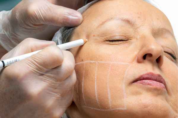 CryoPen: 5 Skin Concerns It May Be Used to Treat 4 What should you ask before having CryoPen treatment Boston?