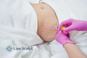 Are The Results From Aqualyx Permanent? 1 Do you want to know how long Aqualyx Boston results last?