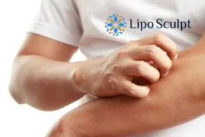 Best Actinic Keratoses Removal 4 prevent your actinic keratoses Boston getting worse - call our team today!