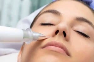 Best Actinic Keratoses Removal 3 Actinic keratoses Boston solutions - book in today!