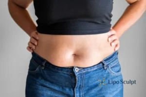 Bidding Farewell to Muffin Tops with Aqualyx Fat Injections 2 Do you wish you could reduce your muffin top Boston With Aqualy fat dissolving injections you can!
