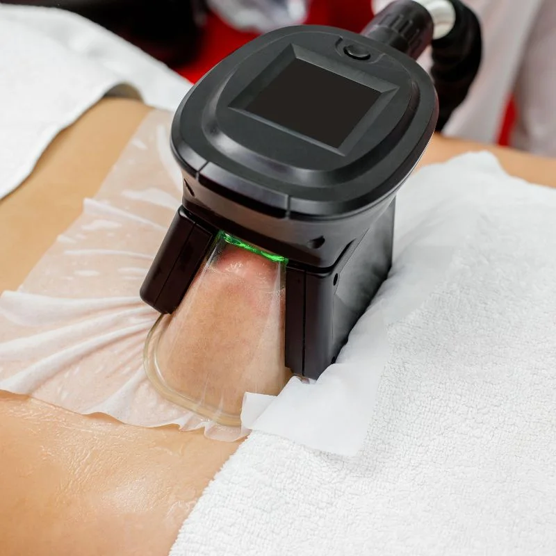 Fat Freezing treatment Boston